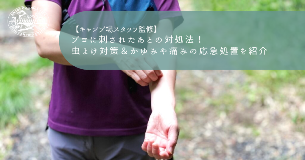 ブヨに刺されたあとの対処法！虫よけ対策＆かゆみや痛みの応急処置を紹介